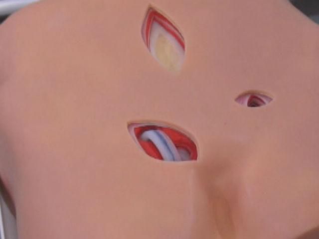 У Одесі медики тренуються на роботах У Одесі медики тренуються на роботах