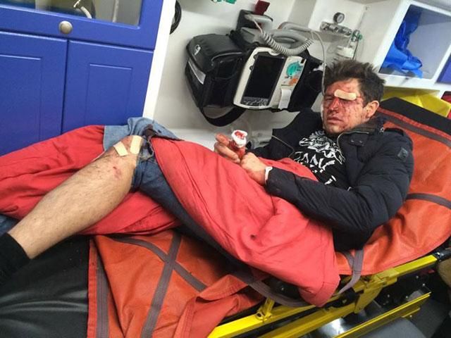 Андрея Джеджулу жестоко избили в Киеве (Фото) Андрея Джеджулу жестоко избили в Киеве (Фото)