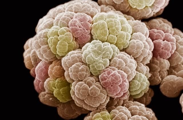 Від супербактерій помиратимуть більше, ніж від раку, — вчені Від супербактерій помиратимуть більше, ніж від раку, — вчені