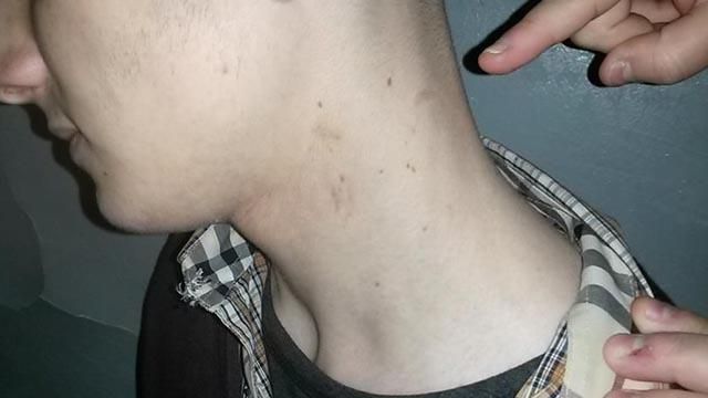 Милиция избила несовершеннолетнего за разбитую витрину Милиция избила несовершеннолетнего за разбитую витрину