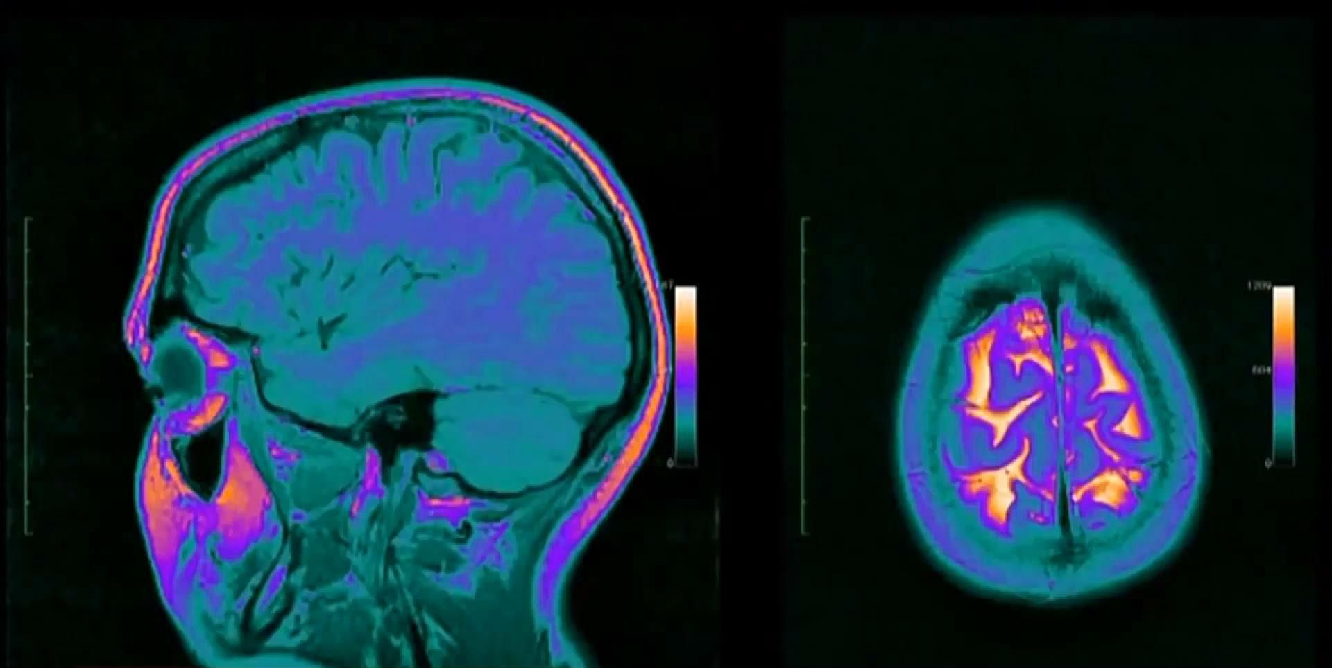 Факти про здоров'я. Загадкові фізичні процеси орагнізму Факти про здоров'я. Загадкові фізичні процеси орагнізму