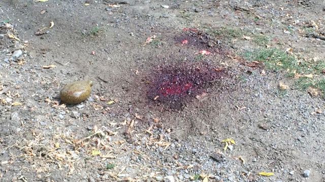 Четверо украинских защитников получили ранения под Мариуполем Четверо украинских защитников получили ранения под Мариуполем