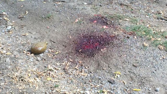 Четверо украинских защитников получили ранения под Мариуполем