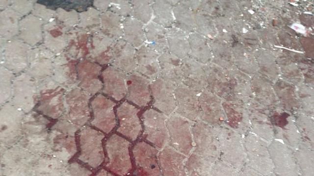 Після обстрілу Маріуполя у місцевому моргу вже 20 тіл, цифра зростає Після обстрілу Маріуполя у місцевому моргу вже 20 тіл, цифра зростає