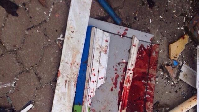 Сили АТО знищили 4 "Гради", якими обстріляли Маріуполь Сили АТО знищили 4 "Гради", якими обстріляли Маріуполь