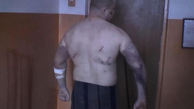 В Бердянской исправительной колонии жестоко избили этапированных осужденных В Бердянской исправительной колонии жестоко избили этапированных осужденных