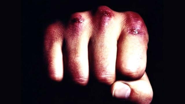 В центрі Івано-Франківська до смерті забили хлопця В центрі Івано-Франківська до смерті забили хлопця