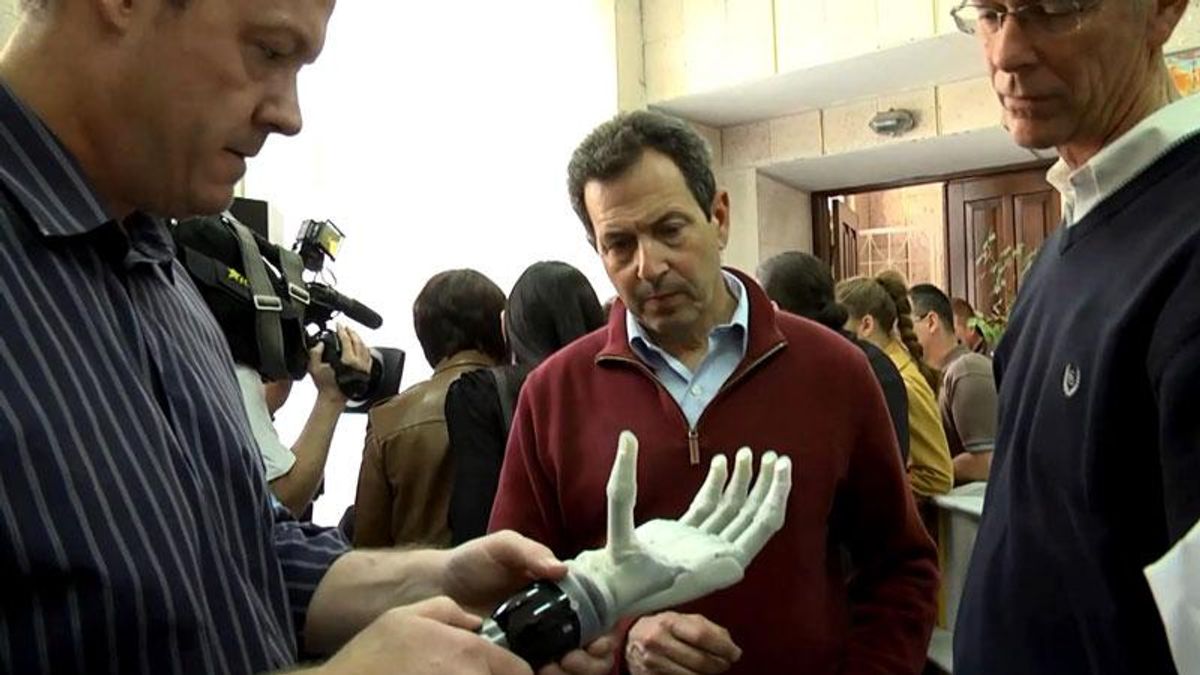 В Киеве напечатали 3D-протез руки для бойца АТО