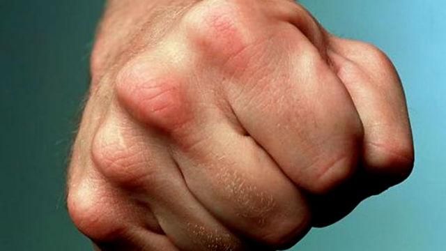 У Києві серед білого дня чоловік до смерті забив друга У Києві серед білого дня чоловік до смерті забив друга