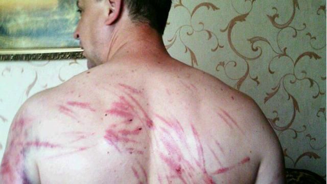 Пастор донецької церкви розповів про жорстоке катування у полоні (18+) Пастор донецької церкви розповів про жорстоке катування у полоні (18+)