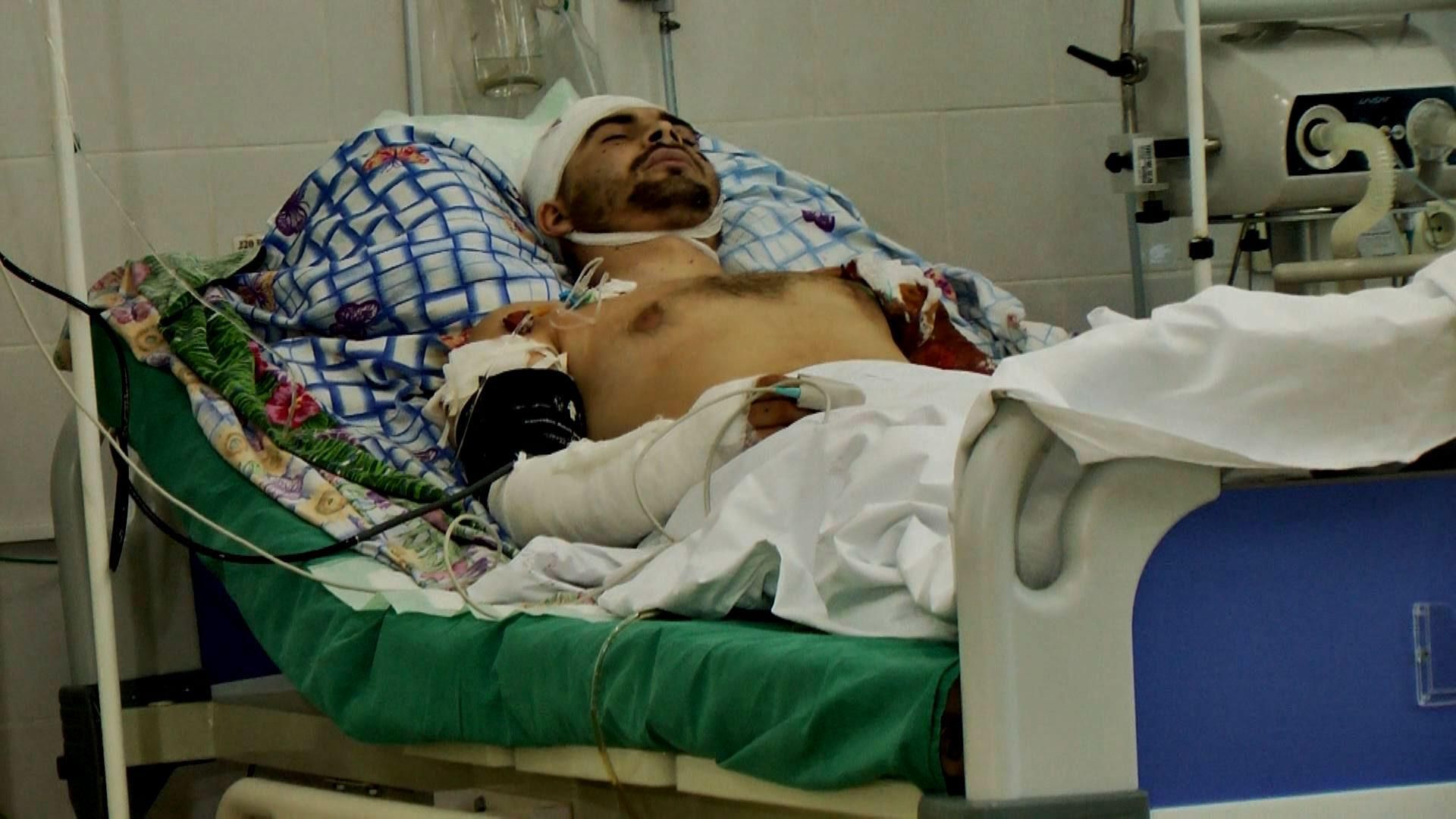 Найкраще "перемир'я" видно у лікарнях Харкова та Дніпропетровська Найкраще "перемир'я" видно у лікарнях Харкова та Дніпропетровська