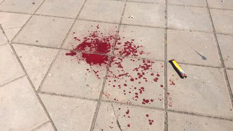 После столкновений на гей-параде милиционер находится в тяжелом состоянии После столкновений на гей-параде милиционер находится в тяжелом состоянии