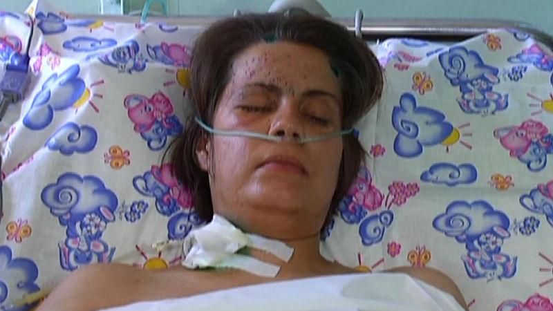 Девушка-волонтер потеряла обе ноги, но хочет и дальше помогать солдатам Девушка-волонтер потеряла обе ноги, но хочет и дальше помогать солдатам