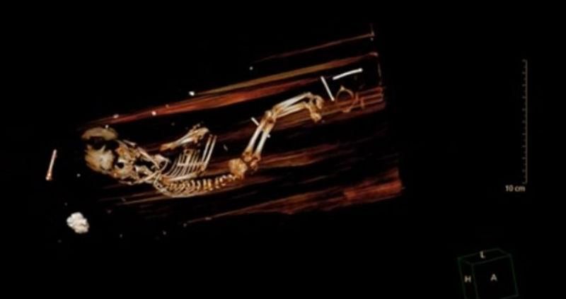 В гробу шведского епископа обнаружили пятимесячный эмбрион В гробу шведского епископа обнаружили пятимесячный эмбрион