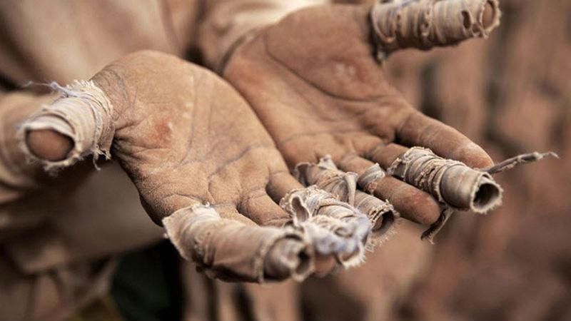 Политика апартеида: 45 лет беспощадного угнетения чернокожих в Африке Политика апартеида: 45 лет беспощадного угнетения чернокожих в Африке