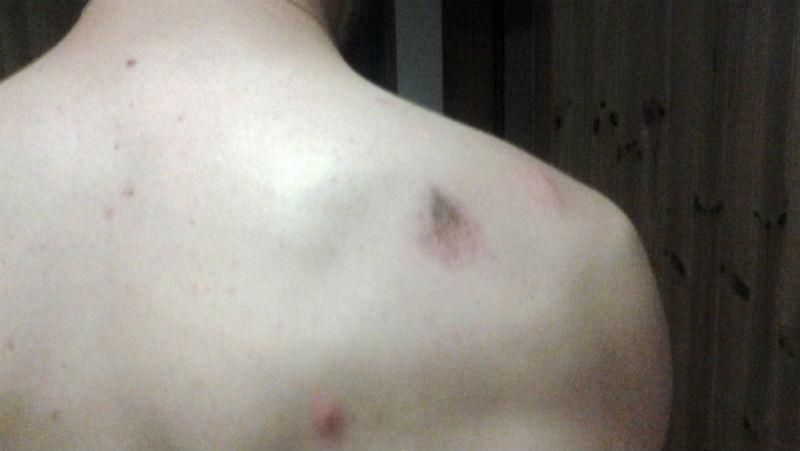 Парня похитили и избили в Киеве Парня похитили и избили в Киеве