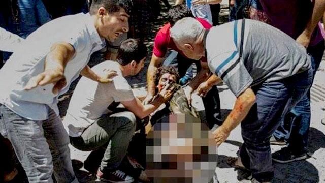 Теракт в Турции: раненых около ста, количество погибших увеличилось