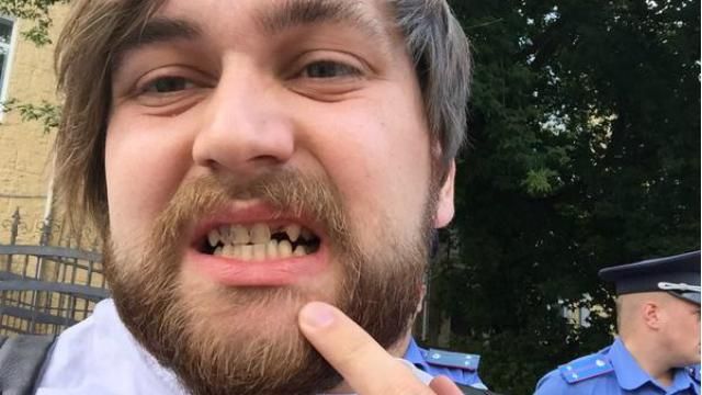 Летели журналисты и камеры: депутаты Ляшко устроили драку Летели журналисты и камеры: депутаты Ляшко устроили драку