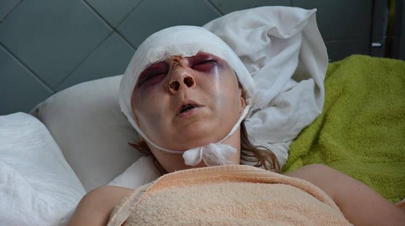 Під КМДА зібрався мітинг через звіряче побиття активістки Під КМДА зібрався мітинг через звіряче побиття активістки