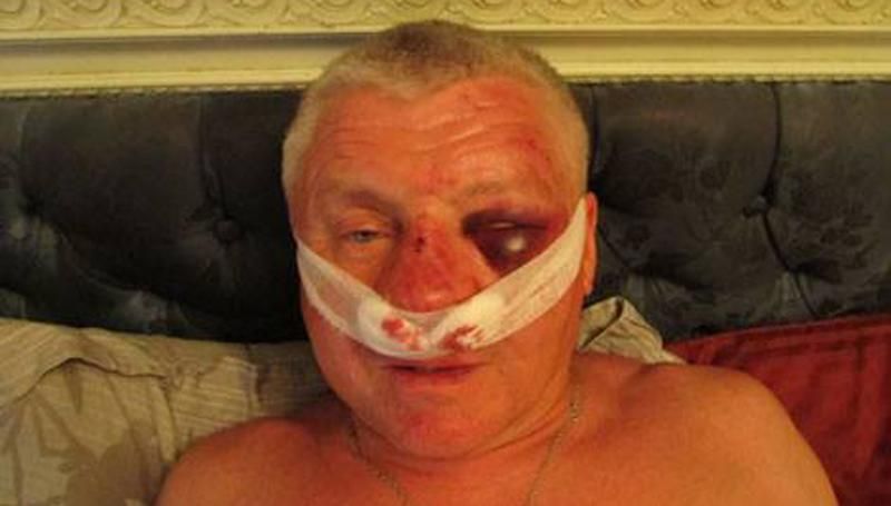 Лідера запорізького "Правого сектора" побили і викрали Лідера запорізького "Правого сектора" побили і викрали