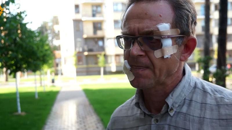 Почастішали напади на борців проти корупції Почастішали напади на борців проти корупції