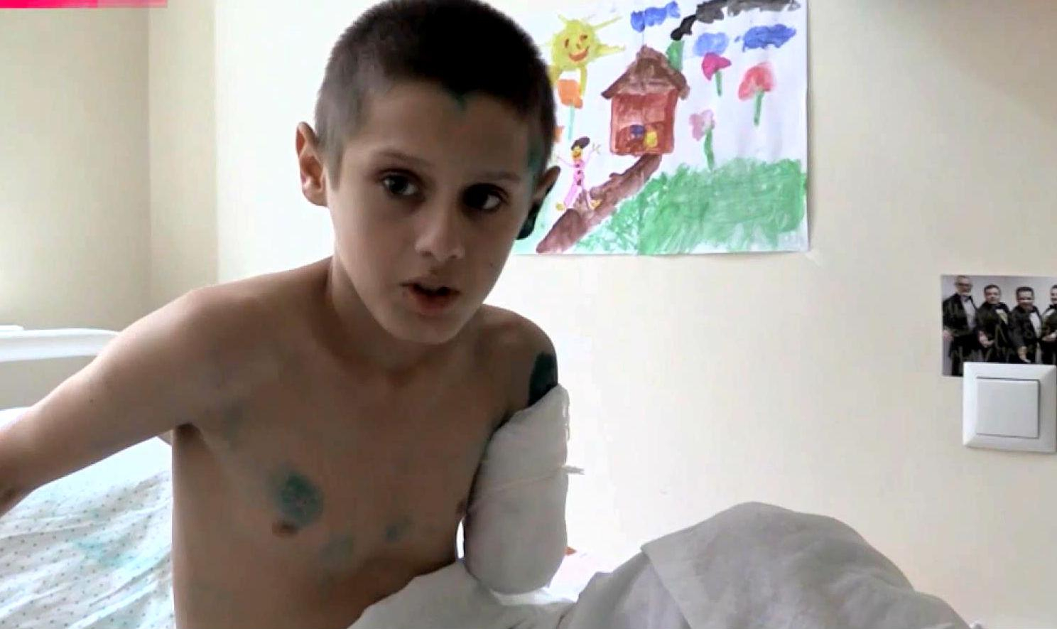 Трое детей потеряли конечности от снаряда террористов