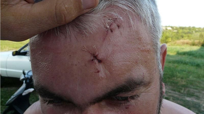 Служитель московского патриархата едва не зарезал украинского священника (18+) Служитель московского патриархата едва не зарезал украинского священника (18+)