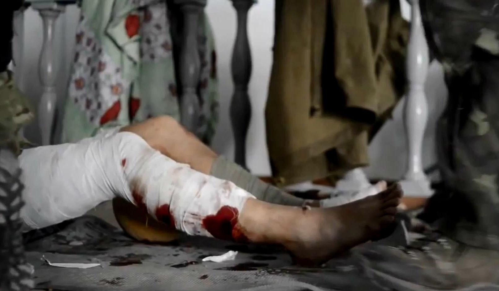 Последствия трагедии в Иловайске Последствия трагедии в Иловайске