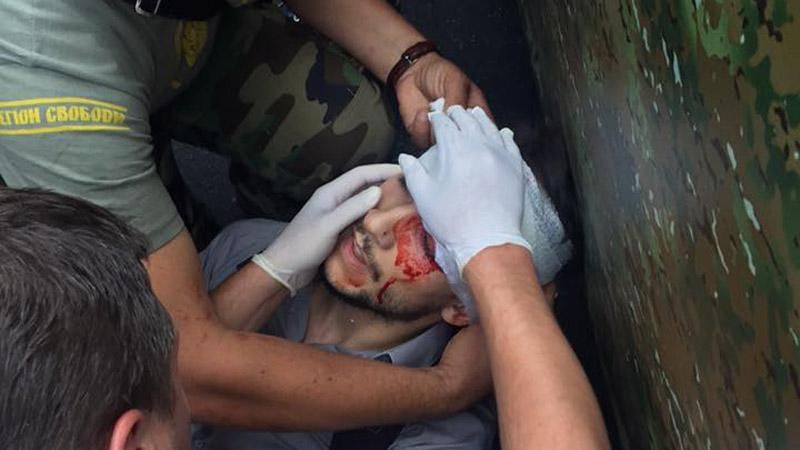 Под Радой ранили иностранного журналиста