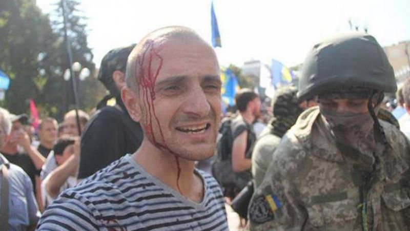 Шокуюча статистика: вогнепальні поранення під Радою отримала 21 особа Шокуюча статистика: вогнепальні поранення під Радою отримала 21 особа