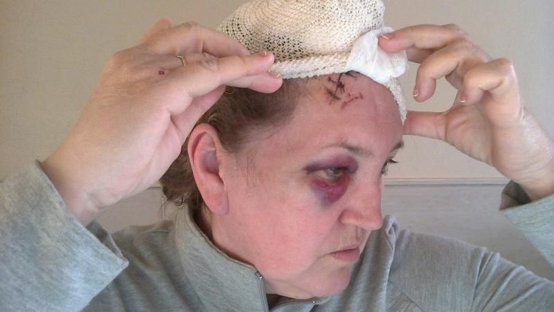 Померла редакторка севастопольського сайту, яку побили кілька місяців тому Померла редакторка севастопольського сайту, яку побили кілька місяців тому