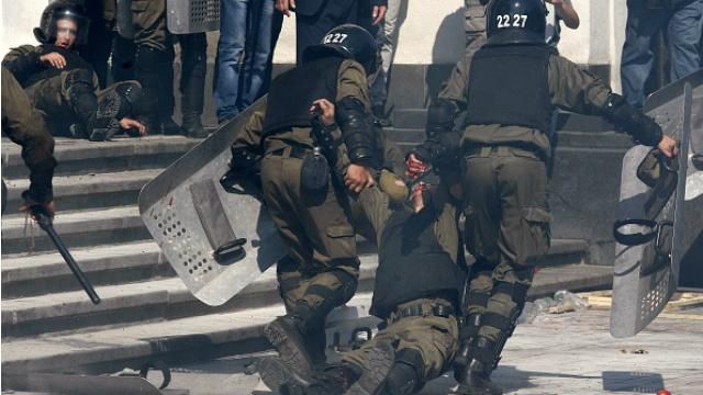 Бій під Радою: журналіст показав осколки, які витягнули з нього Бій під Радою: журналіст показав осколки, які витягнули з нього