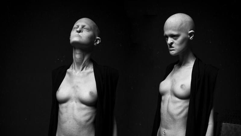 ТОП-10 моделей, чья внешность шокирует ТОП-10 моделей, чья внешность шокирует