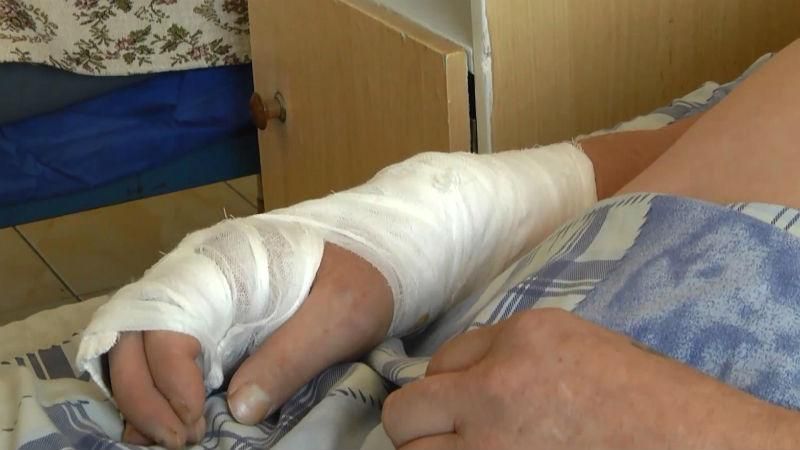 Як помилки недосвідчених лікарів калічать українських героїв Як помилки недосвідчених лікарів калічать українських героїв