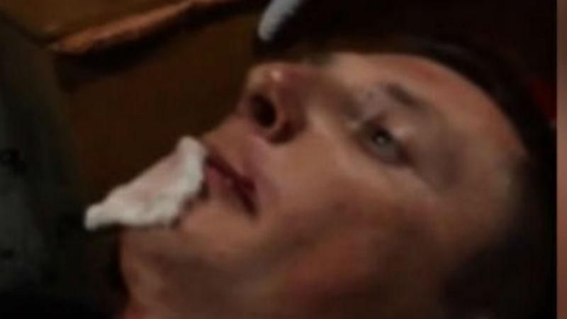 Чемпіон України з боксу влаштував жорстоке побоїще в нічному клубі Чемпіон України з боксу влаштував жорстоке побоїще в нічному клубі