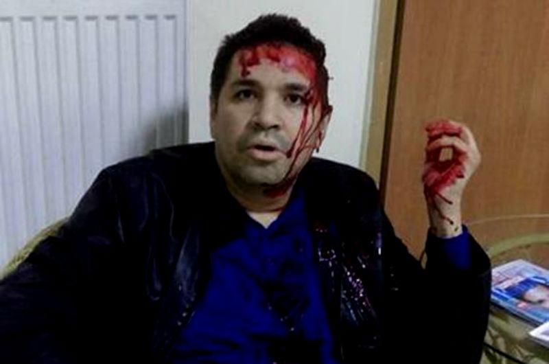 У Харкові жорстоко побили кандидата в мери У Харкові жорстоко побили кандидата в мери