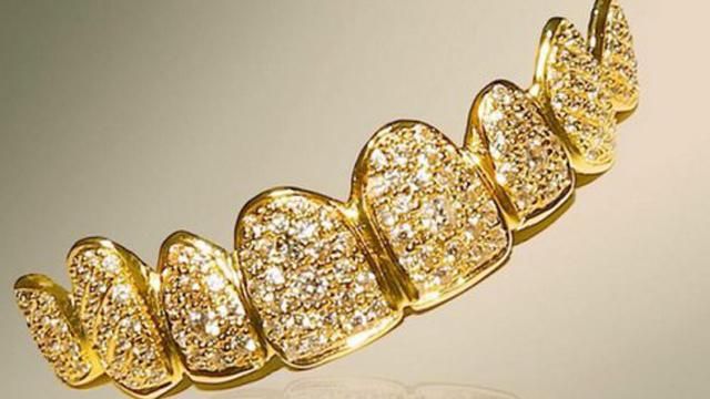 Львовские полицейские нашли золотые зубы на улице Золотой