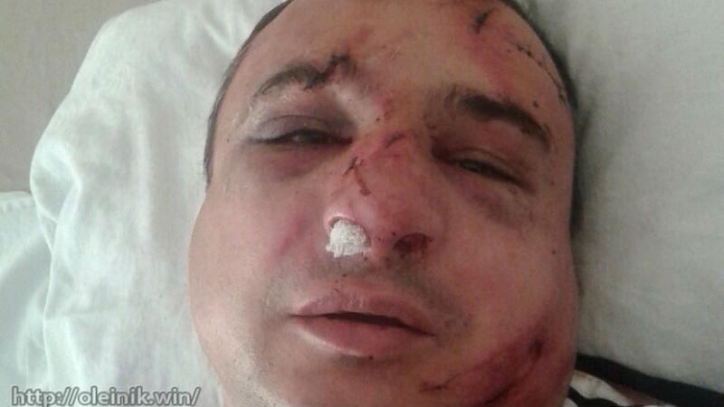 Луганского сепаратиста до полусмерти избили в Киеве Луганского сепаратиста до полусмерти избили в Киеве