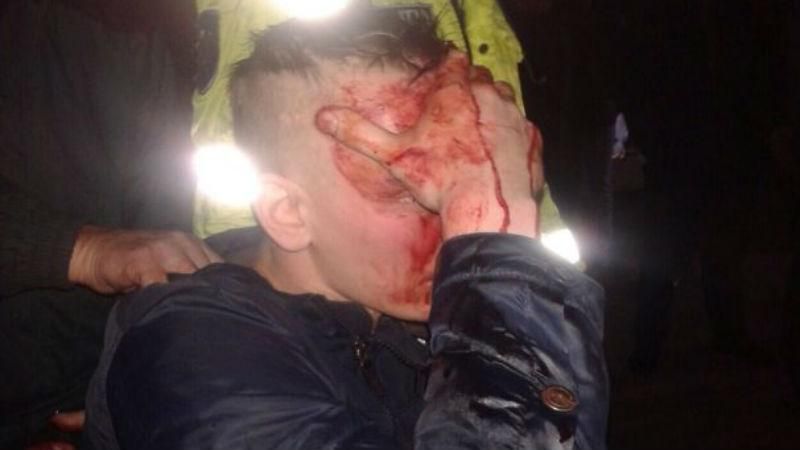 П’яні росіяни побились з молдовськими протестувальниками П’яні росіяни побились з молдовськими протестувальниками