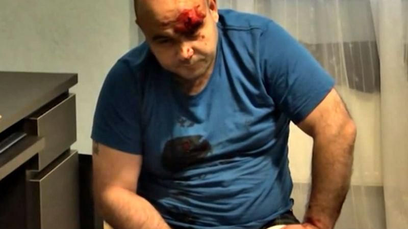 В "ЛНР" жорстоко побили свого міністра за "зв'язок з українською владою" В "ЛНР" жорстоко побили свого міністра за "зв'язок з українською владою"
