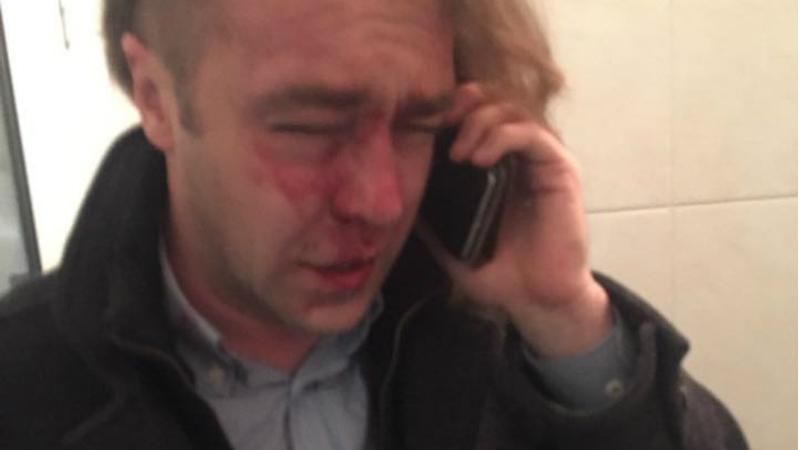 Мірошниченко розповів свою версію бійки в квартирі екс-дружини Мірошниченко розповів свою версію бійки в квартирі екс-дружини