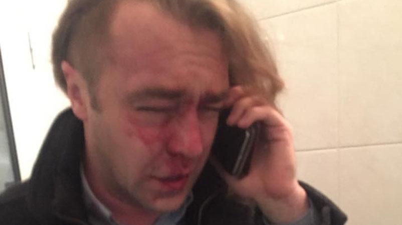 ТОП-новини: загострення ситуації на Донбасі, побитий "свободівець" Мірошниченко ТОП-новини: загострення ситуації на Донбасі, побитий "свободівець" Мірошниченко