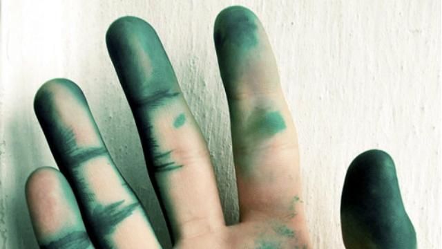 Представників екзит-полів облили зеленкою у Кременчуці Представників екзит-полів облили зеленкою у Кременчуці