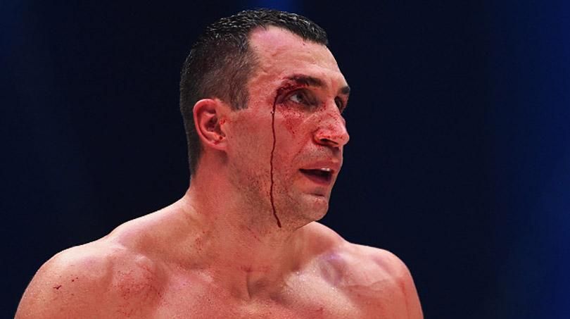 Завтра Володя заявить, що йде в політику, — соцмережі обговорюють поразку Кличка Завтра Володя заявить, що йде в політику, — соцмережі обговорюють поразку Кличка