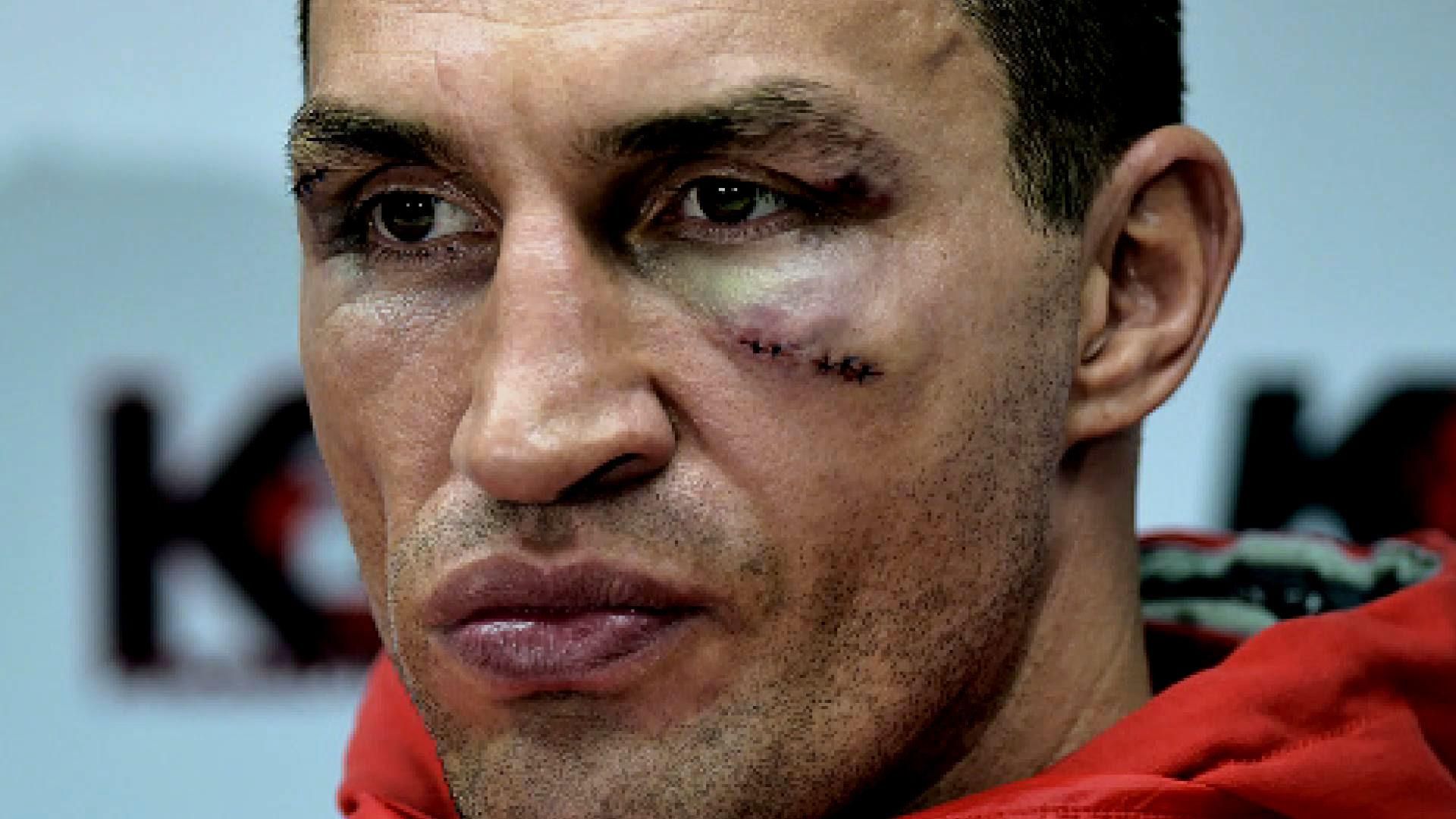 Фатальний бій Кличка — чого далі чекати від боксера Фатальний бій Кличка — чого далі чекати від боксера