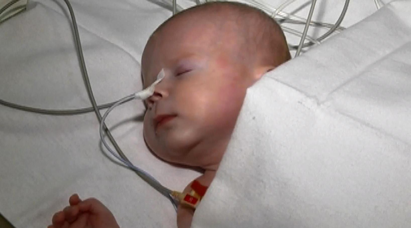 Небайдужі медики рятують життя хворого малюка, від якого відмовились батьки