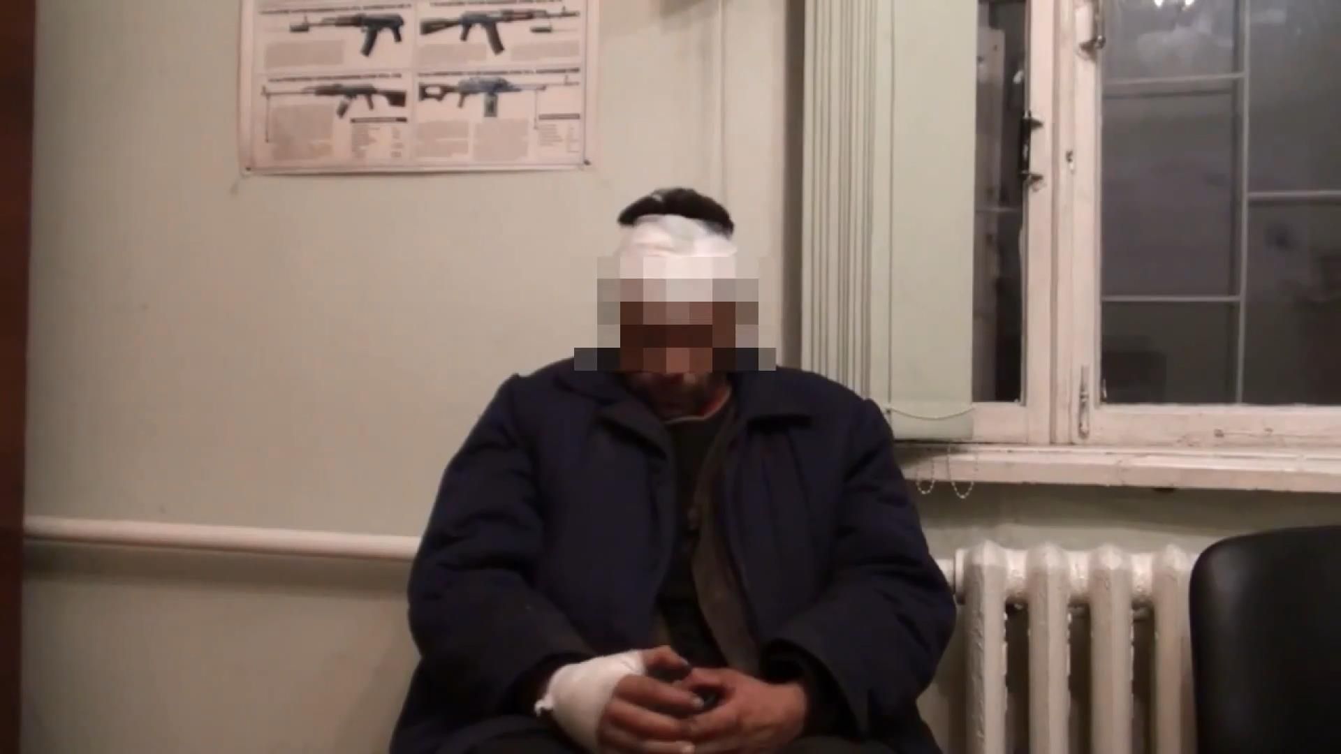 Бойовики по-звірячому познущалися з мешканця Горлівки Бойовики по-звірячому познущалися з мешканця Горлівки