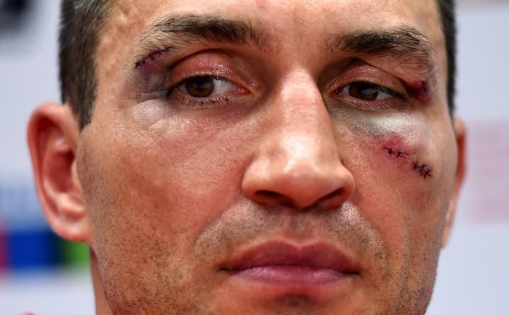 Стало відомо, коли відбудеться матч-реванш Кличка та Ф'юрі
