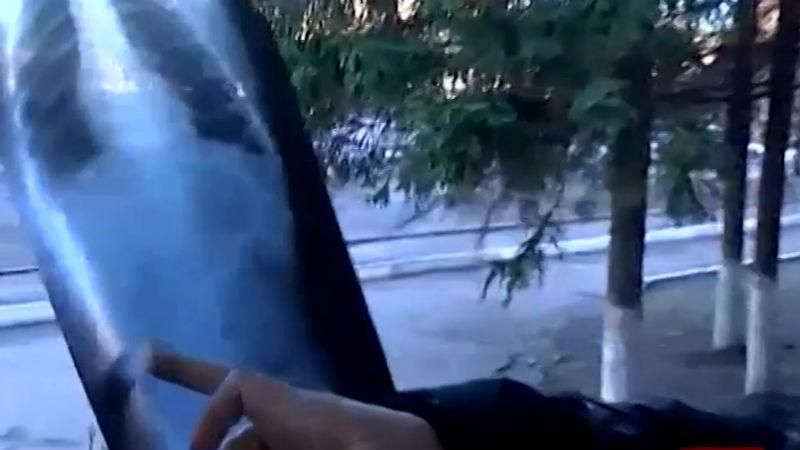 Скандал у Харкові. Хірург забув у животі дитини великий металевий дріт Скандал у Харкові. Хірург забув у животі дитини великий металевий дріт