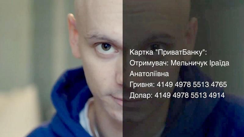 Київський актор театру і кіно бореться зі страшною хворобою